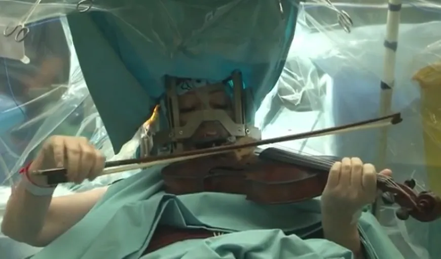 O violonistă a dat un adevărat recital în timp ce era operată pe creier VIDEO