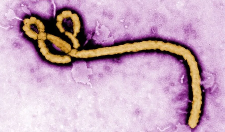 Virusul Ebola poate persista cel puţin nouă luni în sperma unor supravieţuitori ai infecţiei