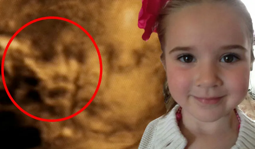 Chipul unui „înger păzitor” a apărut pe ecografia 4D a unei fetiţe FOTO