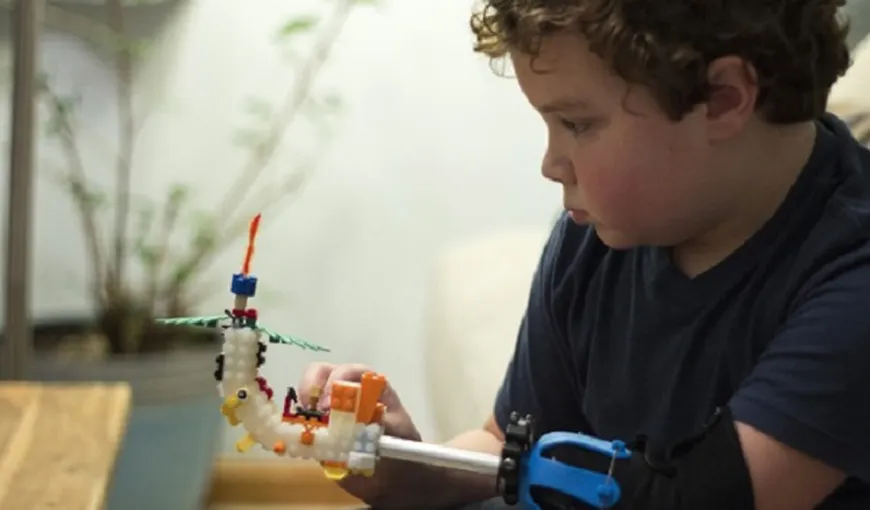 Povestea EMOŢIONANTĂ a băieţelului care şi-a construit singur o proteză din PIESE DE LEGO