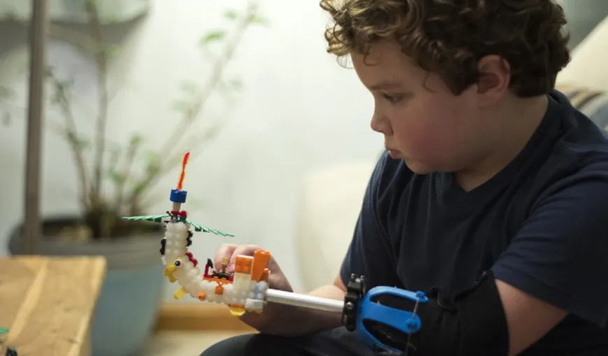 Un copil şi-a făcut singur o PROTEZĂ BIONICĂ funcţională cu ajutorul unor elemente de Lego