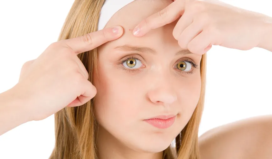 Cum îngrijeşti tenul acneic? Dr. Daniela Taher îţi oferă cele mai utile sfaturi