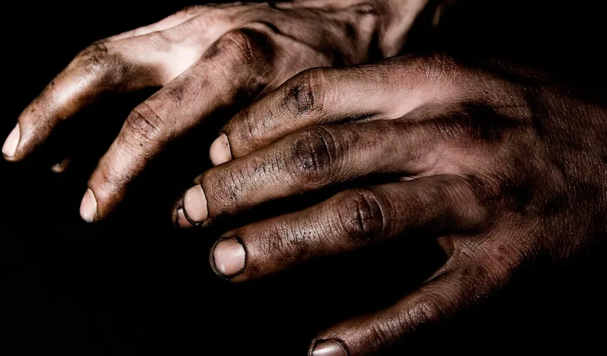 Ce este „boala mâinilor murdare”