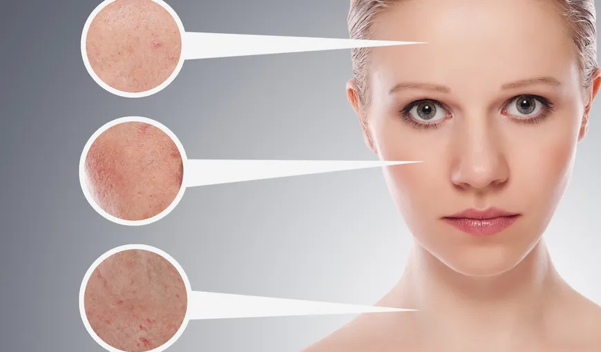 Afecţiuni ale pielii care îţi pot semnala alte probleme de sănătate