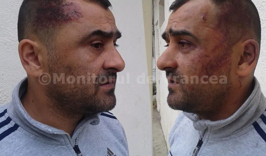 Antrenor de fotbal, bătut şi tâlhărit la Focşani. El şi jucătorii au fost atacaţi cu bastoane telescopice