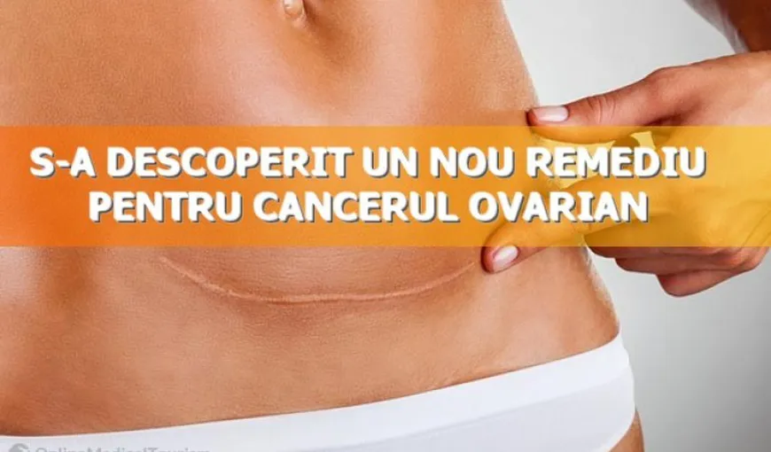 S-a descoperit un nou remediu pentru cancerul ovarian