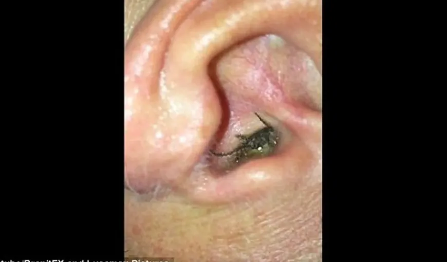 Un american a descoperit cu ajutorul unui iPhone ca are un paianjen în ureche. Cum a reacţionat. VIDEO