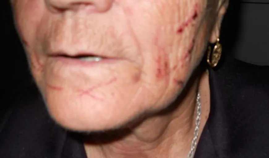 O femeie de 69 de ani a fost bătută de două vecine din invidie