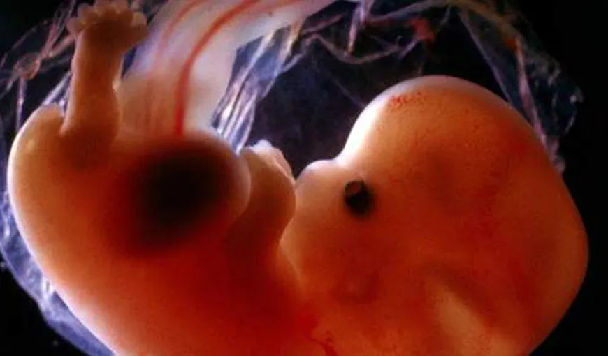 Descoperire şocantă. O femeie a purtat în pântece un fetus mumificat, timp de 50 de ani