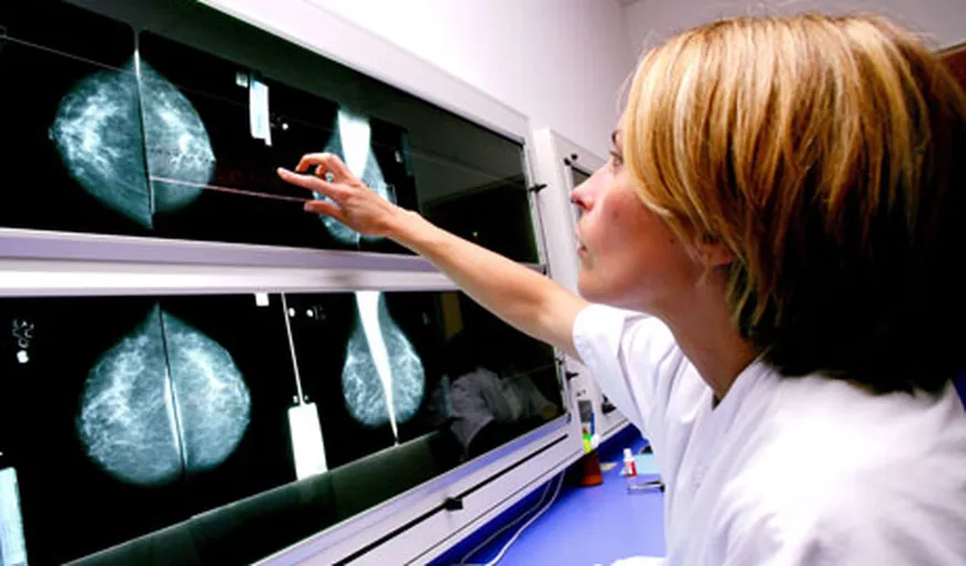 Eficacitatea mamografiilor a fost mult supraestimată până acum