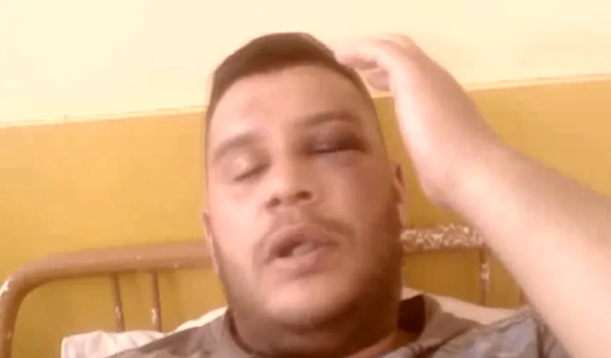 Un tânăr, în stare gravă la spital după ce a fost bătut de fiul unui fost procuror VIDEO