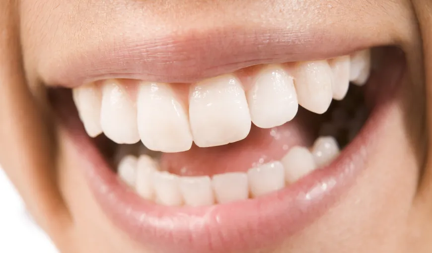 Cum refaci smalţul dinţilor în mod natural