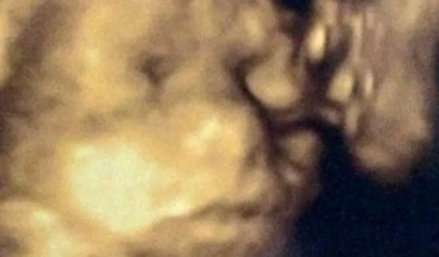 O femeie însărcinată a avut ŞOCUL vieţii ei la ecografie! Cine îi săruta bebeluşul din pântece