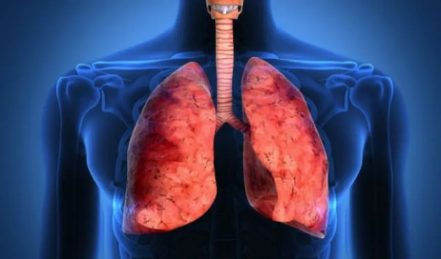 Un nou tratament pentru cancerul pulmonar, aprobat de Comisia Europeană