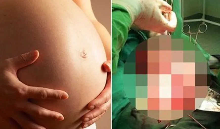 O femeie a crezut că este însărcinată, dar a fost devastată după ce a văzut că bebeluşul ei era altceva
