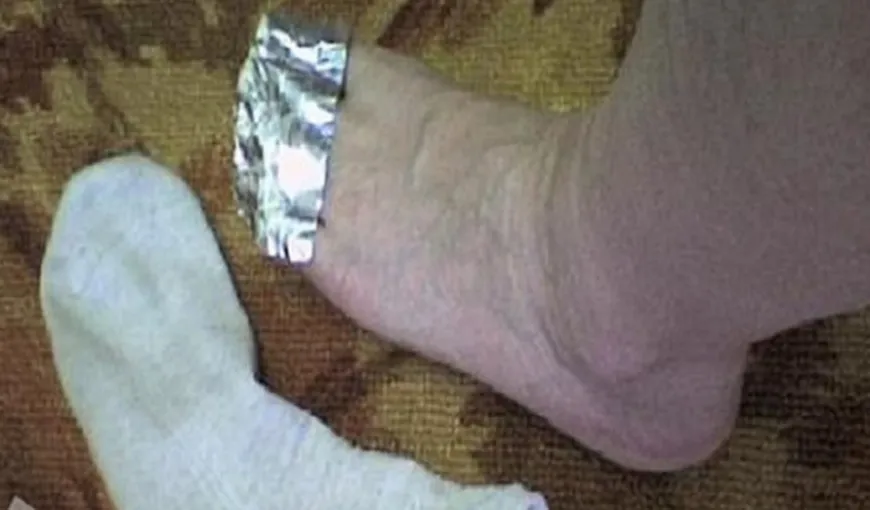 De ce e bine să-ţi pui folie de aluminiu pe degetele picioarelor
