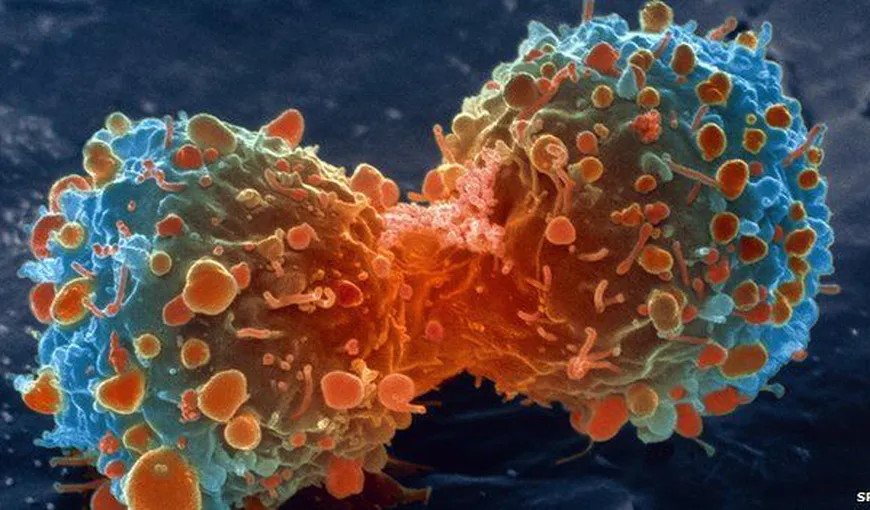 STUDIU: Cancerul poate fi provocat de cromul prezent în suplimentele alimentare