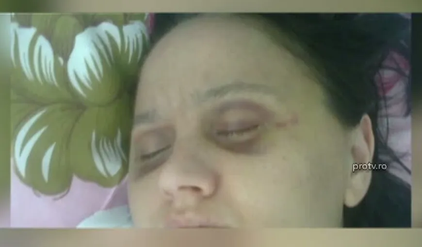 O femeie din Timiş a fost bătută crunt de iubitul cunoscut pe internet