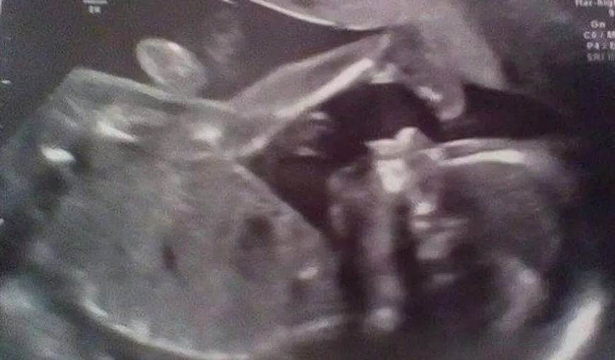 Şocul unei gravide: A văzut o fantomă pe ecografia cu bebeluşul ei nenăscut