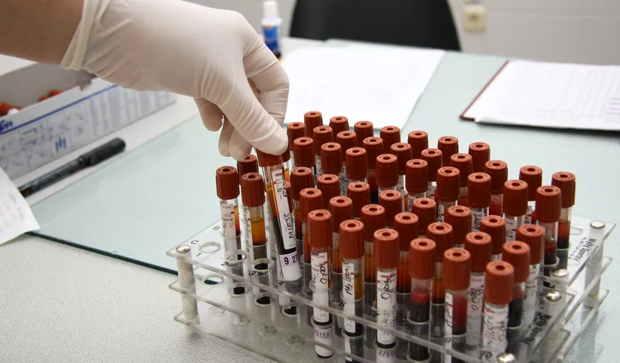 Test sangvin pentru detectarea precoce a cancerului, rezultate promiţătoare