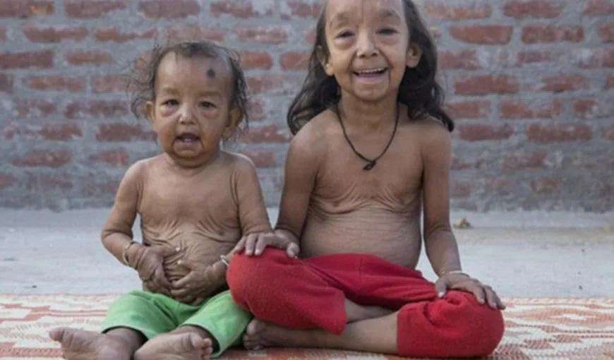 Povestea lui Benjamin Button e reală. Cum trăiesc doi copii bătrâni din India