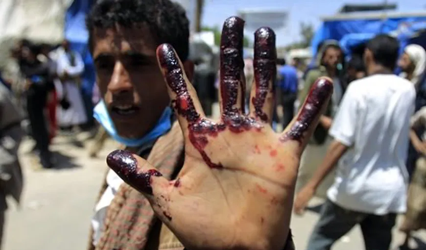 Raid aerian al coaliţiei arabe în Yemen. Cel puţin 30 de morţi din rândul rebelilor şiiţi şi al civililor