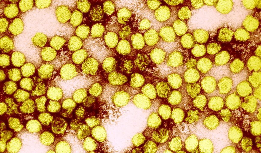 Epidemia de febră galbenă se extinde în Angola: Cel puţin 250 de persoane au murit