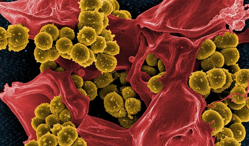 Cum scapi de bacteria care provoacă ulcer
