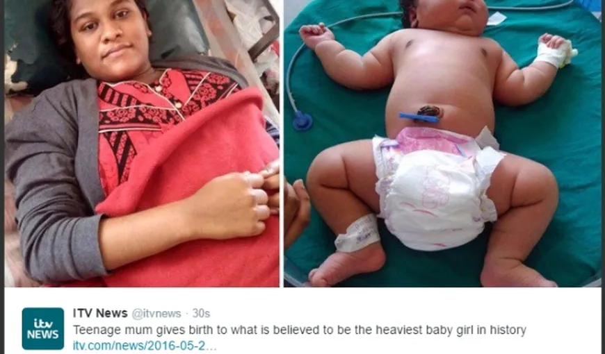 S-a născut fetiţa cu greutatea unui copil de şase luni. Este din India şi cântărea la naştere şapte kilograme