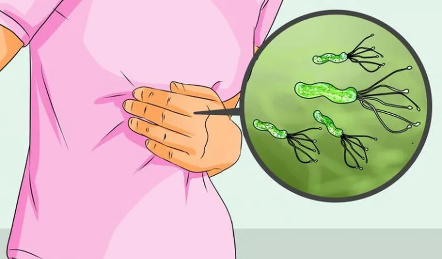 Cum se transmite bacteria care produce cancerul de stomac. Jumătate din oameni o au