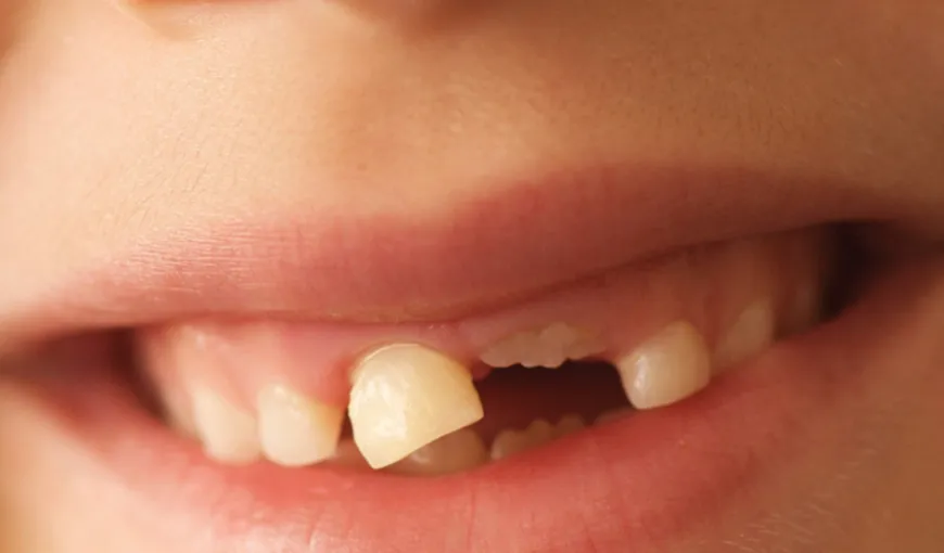 Erupţia dentară: Remedii testate pentru calmarea gingiilor dureroase