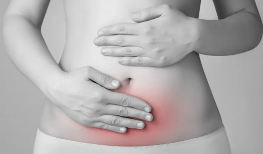 Ce este sindromul ovarelor polichistice?