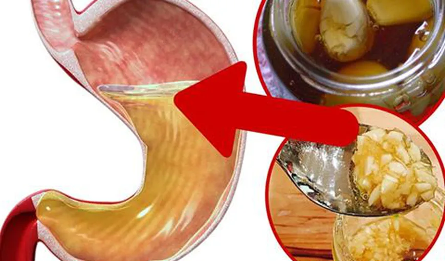Ce se întâmplă dacă mănânci usturoi cu miere pe stomacul gol