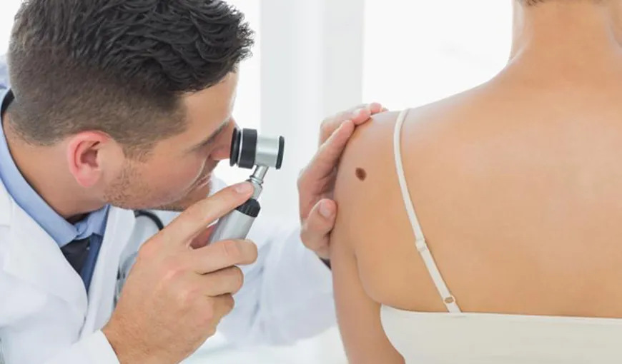 Cancerul de piele: experţii pun la îndoială utilitatea screening-ul anual