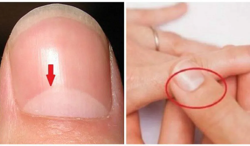Ştii ce înseamnă semiluna de pe unghiile tale? Răspunsul este mai important decât crezi