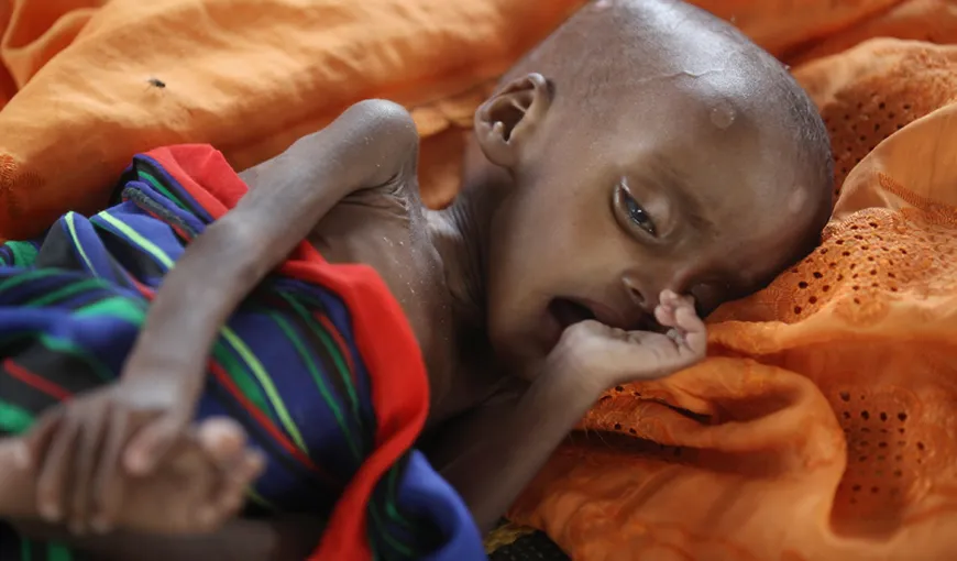 UNICEF: Cinci din şase copii sub doi ani sunt subnutriţi, cu risc ireversibil pentru sănătate
