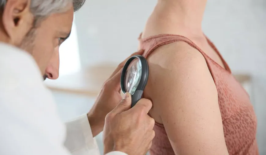 Mii de pacienţi europeni cu melanom nu au acces la noile medicamente şi metode de tratament