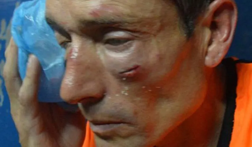 Scene de violenţă rară pe terenul de fotbal. Un arbitru a fost bătut cu bestialitate de jucători şi suporteri VIDEO