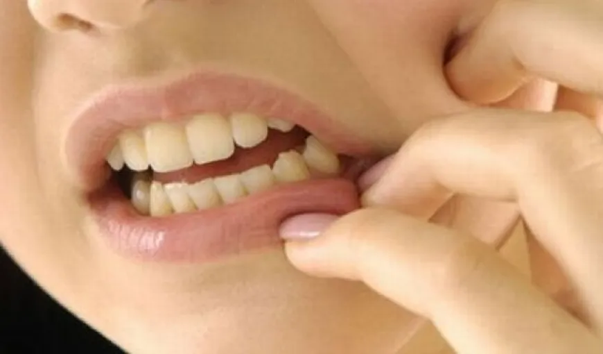 7 lucruri de ştiut despre implantul dentar
