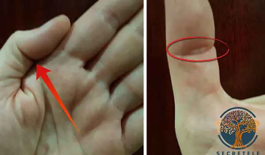 Persoanele cu acest contur la deget sunt speciale. Tu îl ai?