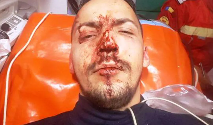 Taximetrist snopit în bătaie de patron la Focşani VIDEO