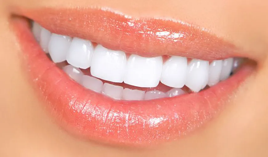 5 probleme dentare tratate cu faţetele dentare