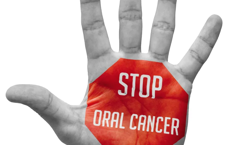Peste 500 de cazuri de cancer oral sunt descoperite anual de medici, 60 la sută fiind neoperabile
