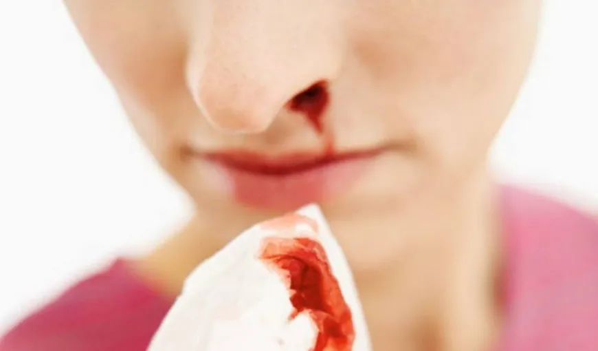 De ce curge sânge din nas