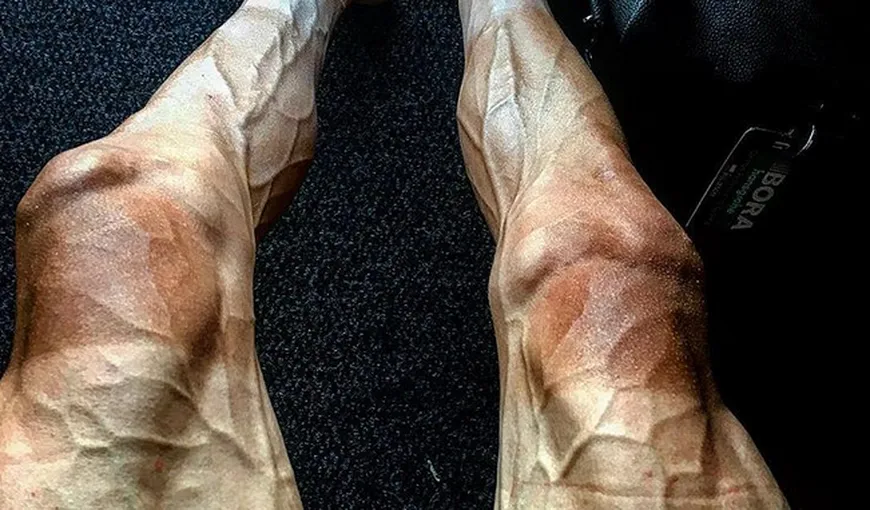 Imagini înfiorătoare. Cum arată picioarele unui ciclist din Turul Franţei FOTO