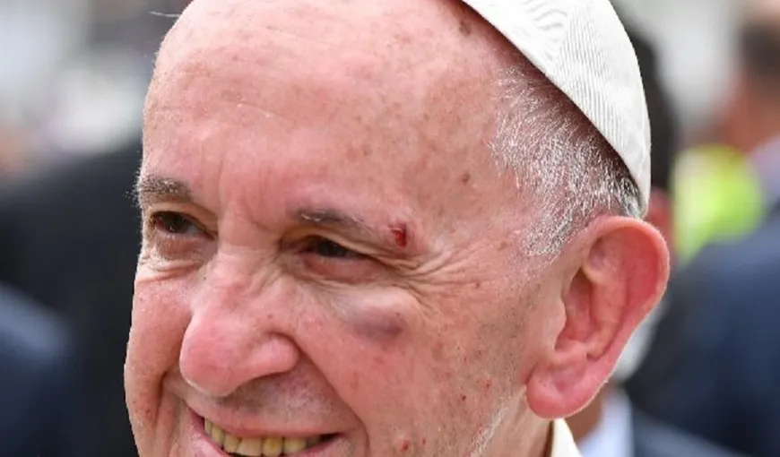 Papa Francisc s-a rănit în timp ce mergea cu papamobilul, în Columbia VIDEO