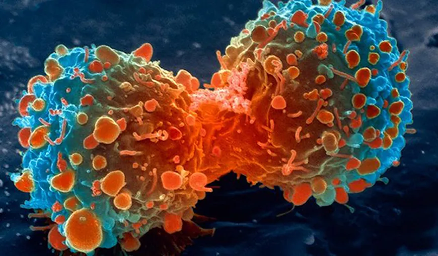 O nouă opţiune de tratament inovator compensat pentru pacienţii cu un tip de cancer foarte agresiv