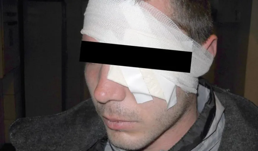 Tânăr bătut într-un bar din Cluj. Iubita acestuia a asistat la întreaga scenă