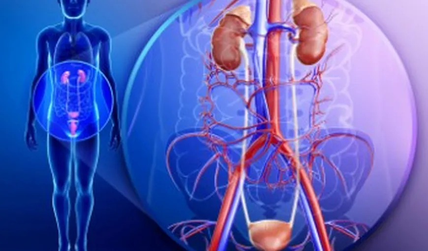 Descoperă complicaţiile rinichiului polichistic