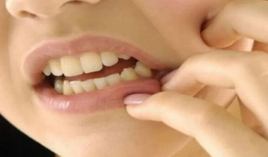 Simptome dentare pe care nu trebuie să le ignori